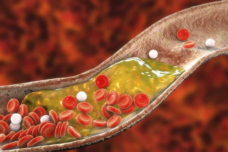 نقش عصاره مخمر در کاهش میزان کلسترول خون